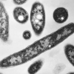 Alerta sanitaria en NY: Brote de legionelosis causa dos muertes y decenas de contagios.