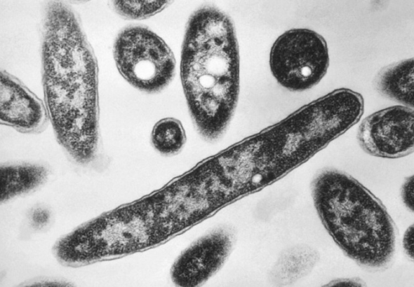 Alerta sanitaria en NY: Brote de legionelosis causa dos muertes y decenas de contagios.
