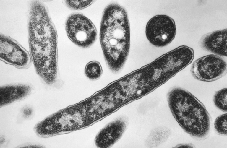 Alerta sanitaria en NY: Brote de legionelosis causa dos muertes y decenas de contagios.