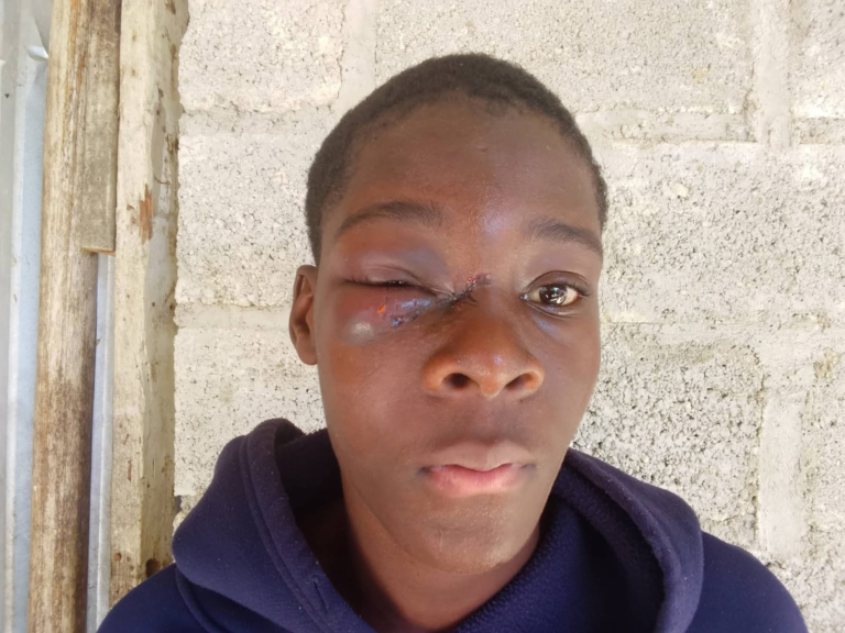 Joven denuncia golpe en un ojo durante revisión policial en San Luis